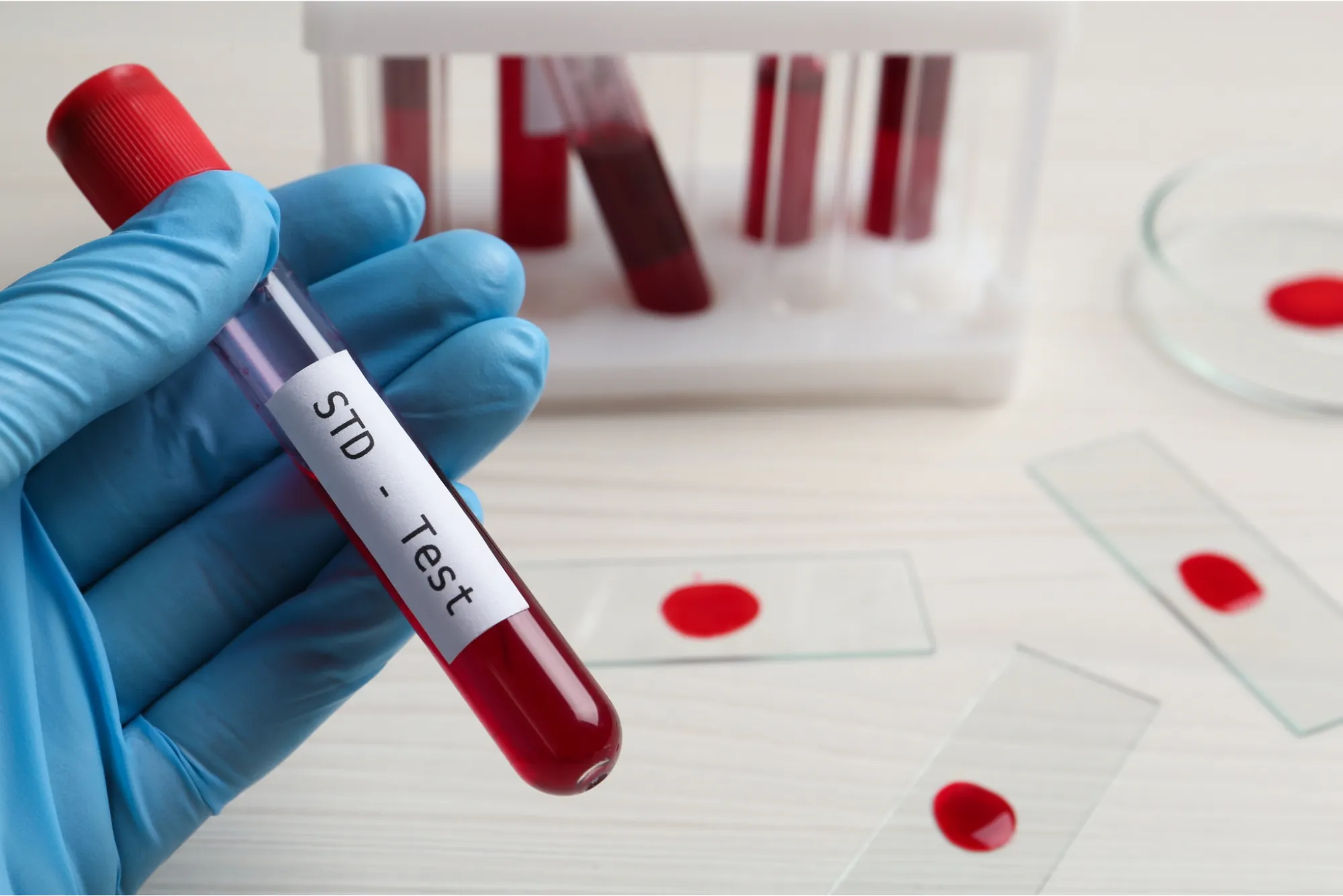 STI Screening in Dubai